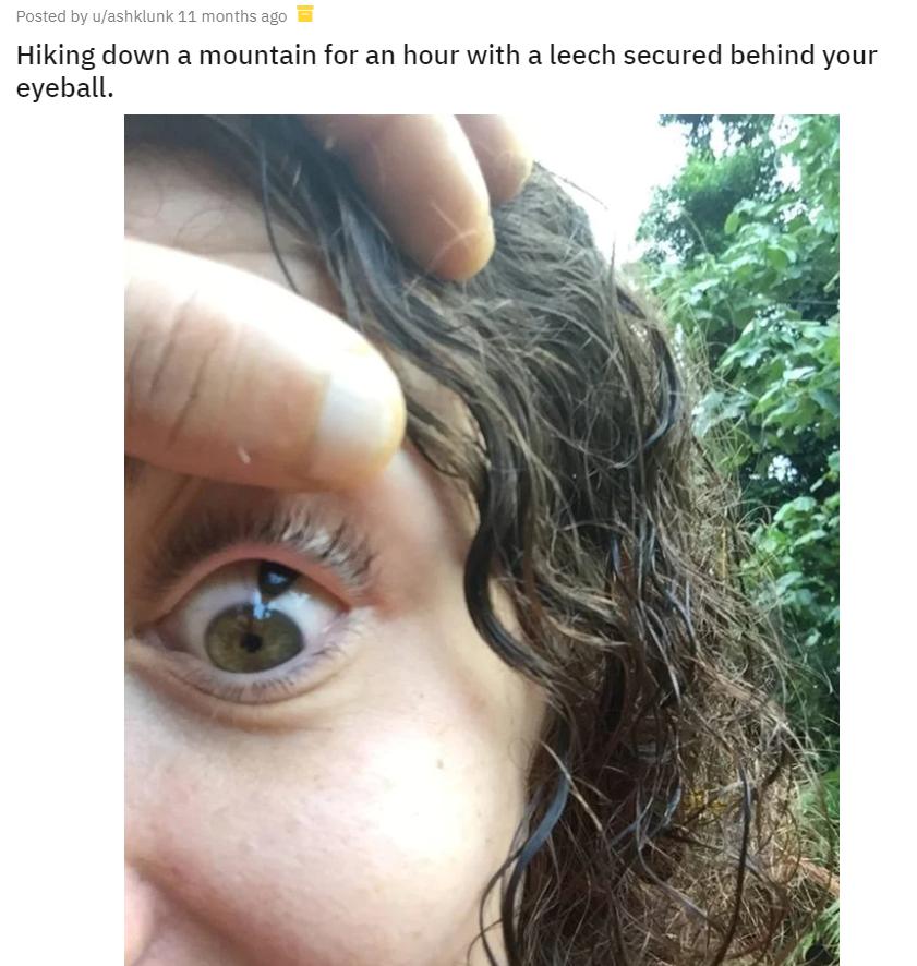 男孩被蚂蚁吓死,蚂蝗寄生在五岁男孩身体里一年