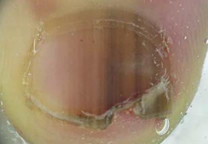 宝宝指甲出现白点,孩子指甲上有白色斑点倪海厦