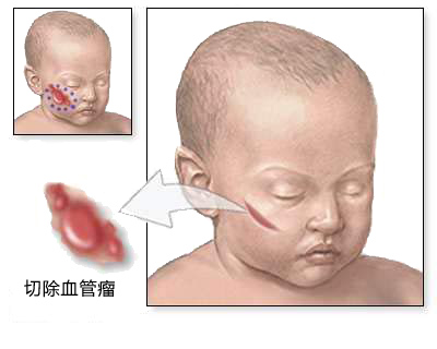 宝宝出院检测,宝宝出院回家家人的反应
