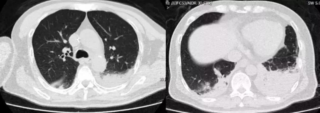 抗菌药物不合理处方分析,抗菌药物用药不合理的表现