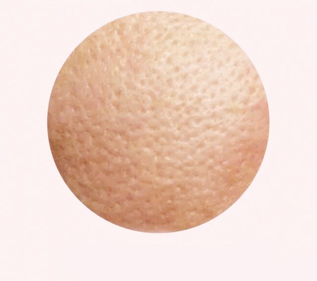 混合皮肤屏障受损护肤套装推荐,皮肤屏障受损毛孔粗大怎么护肤