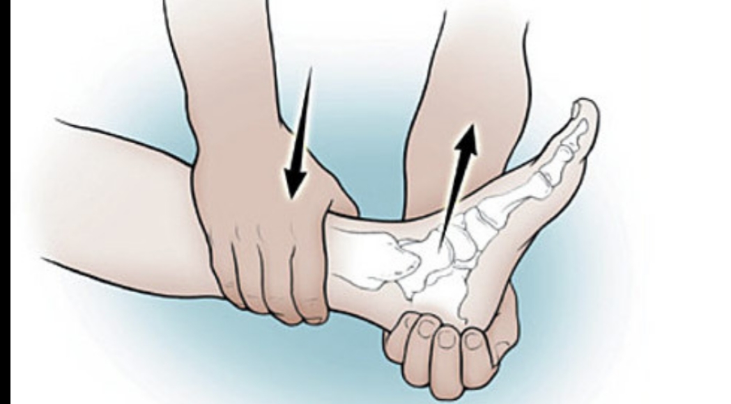 足踝扭伤疼痛位置图,踝足扭伤机制