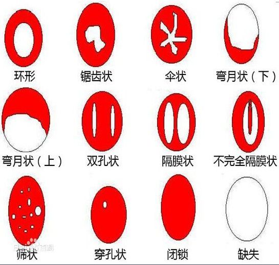 千万不要和处女座在一起,千万不要和结婚的人谈恋爱