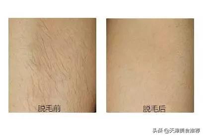 99元团购美睫,附近美睫19.9元秒杀