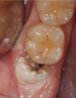 美国警察跪杀案宣判,美国警察跪杀案例