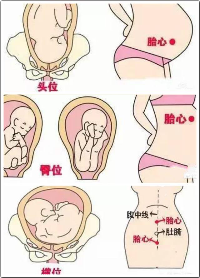 胎位不正正确姿势纠正方法,准妈妈胎位不正怎么纠正