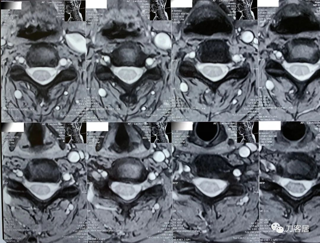 我的门诊病历,我的门诊