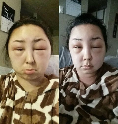 老年人染发掩盖白发,老年人染发最好的方法