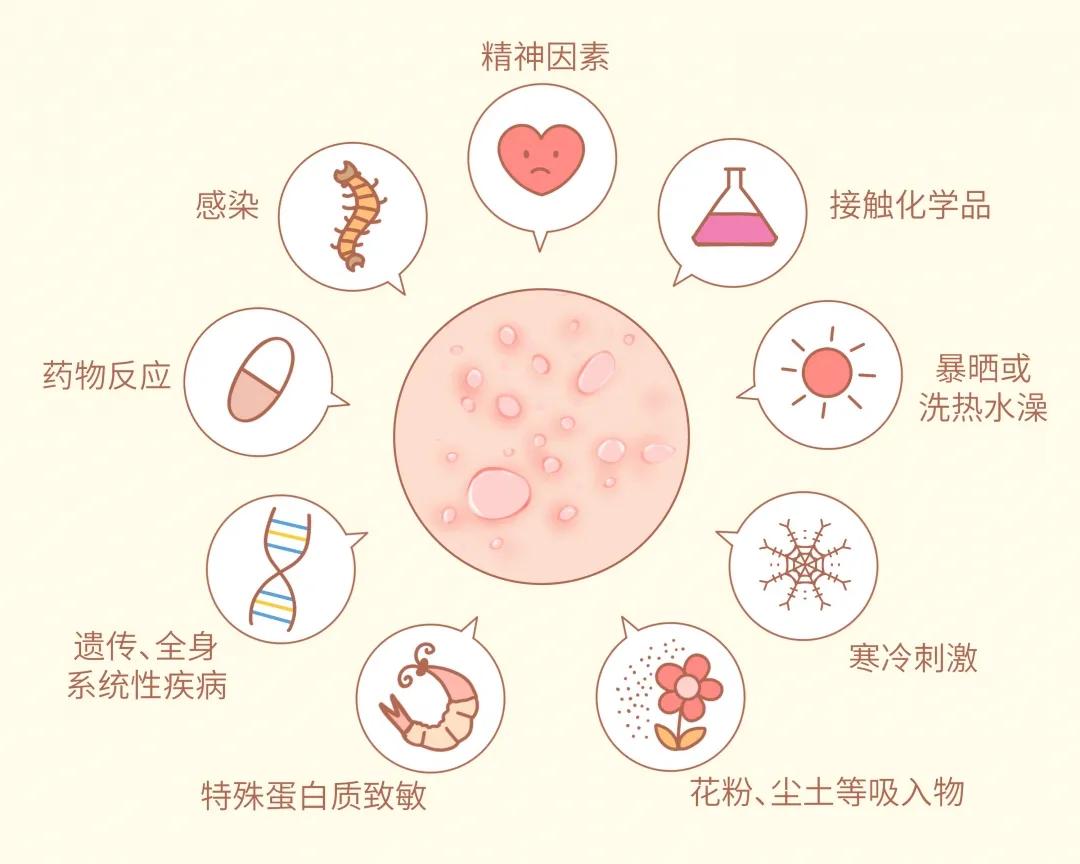阿嚏~不好意思，我对这个过敏