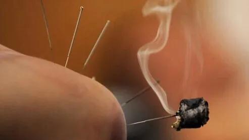 经筋疗法资料大全图解视频教程,经筋疗法讲解