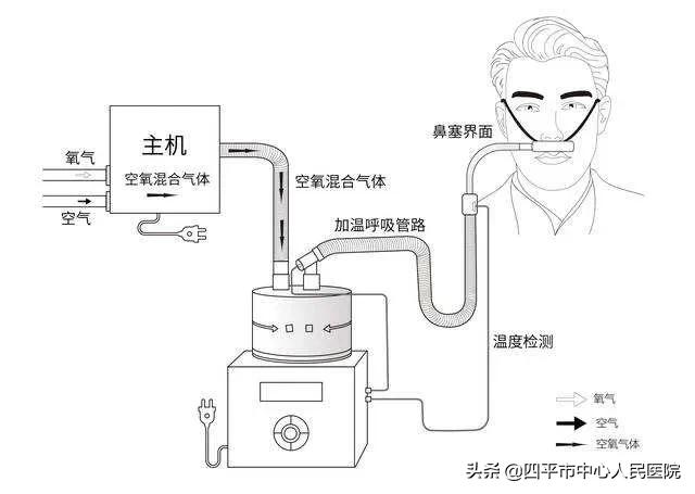 icu中的救命神器,icu里的救命药