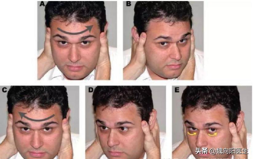 良性位置性眩晕鉴别,怎样判断眩晕是颈椎还是耳石症