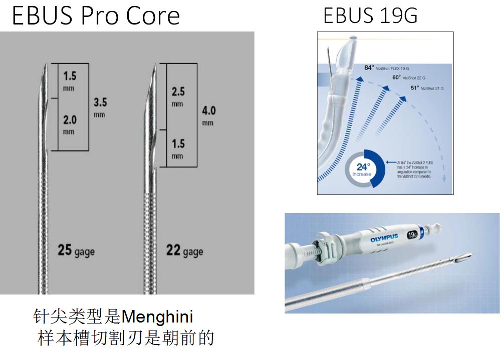 孙加源门诊,治疗肺癌的新技术新手段