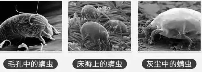 脸上螨虫多出油厉害怎么办,脸上螨虫过敏烂脸
