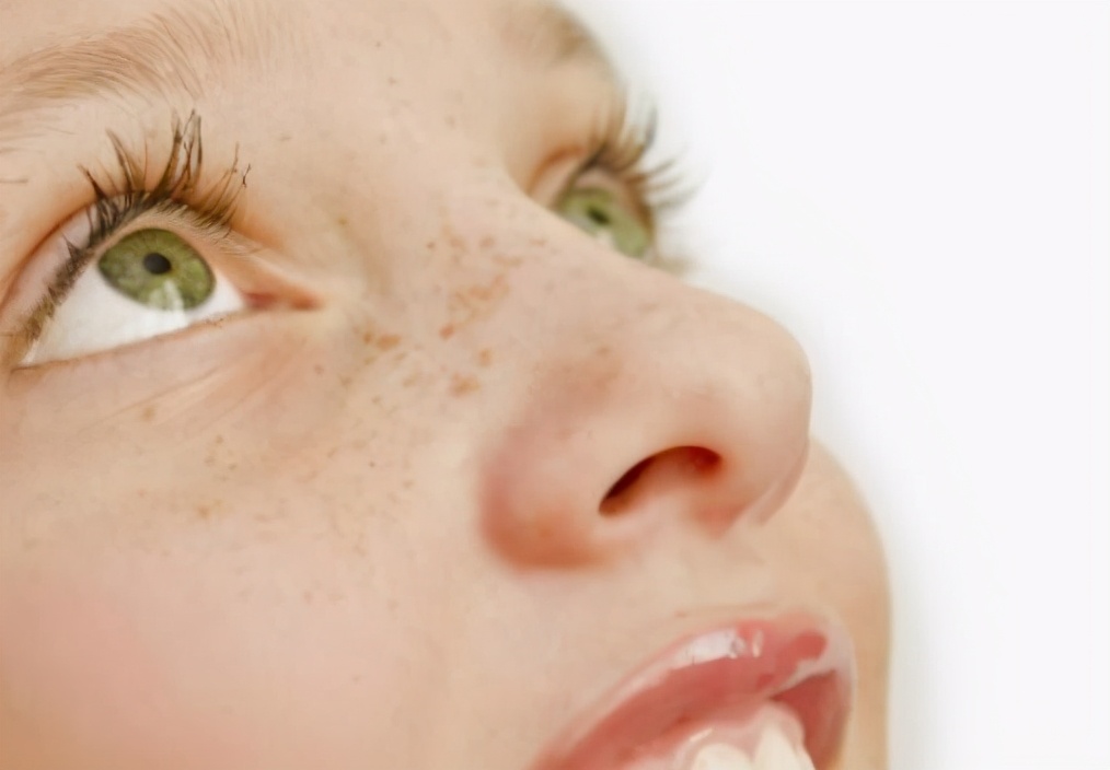 脸上的色斑是怎么来的,脸上色斑是怎么来的