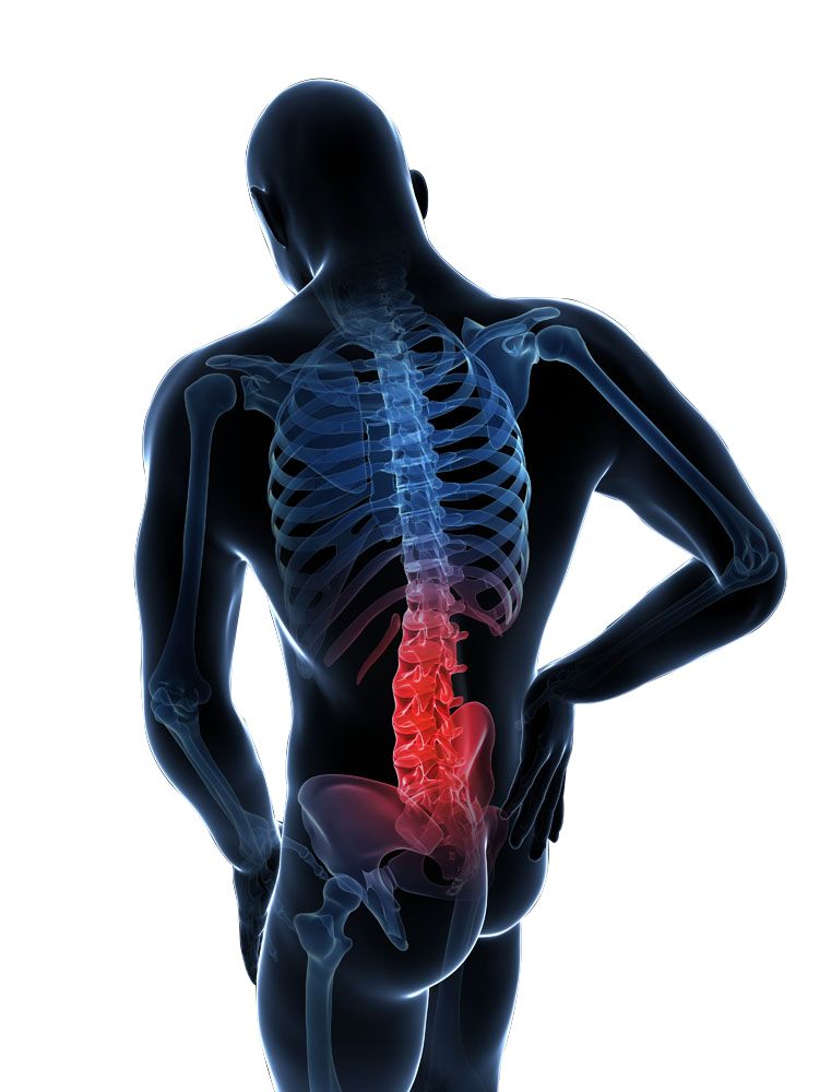 着凉久卧腰疼怎么解决,居家腰疼怎么解决