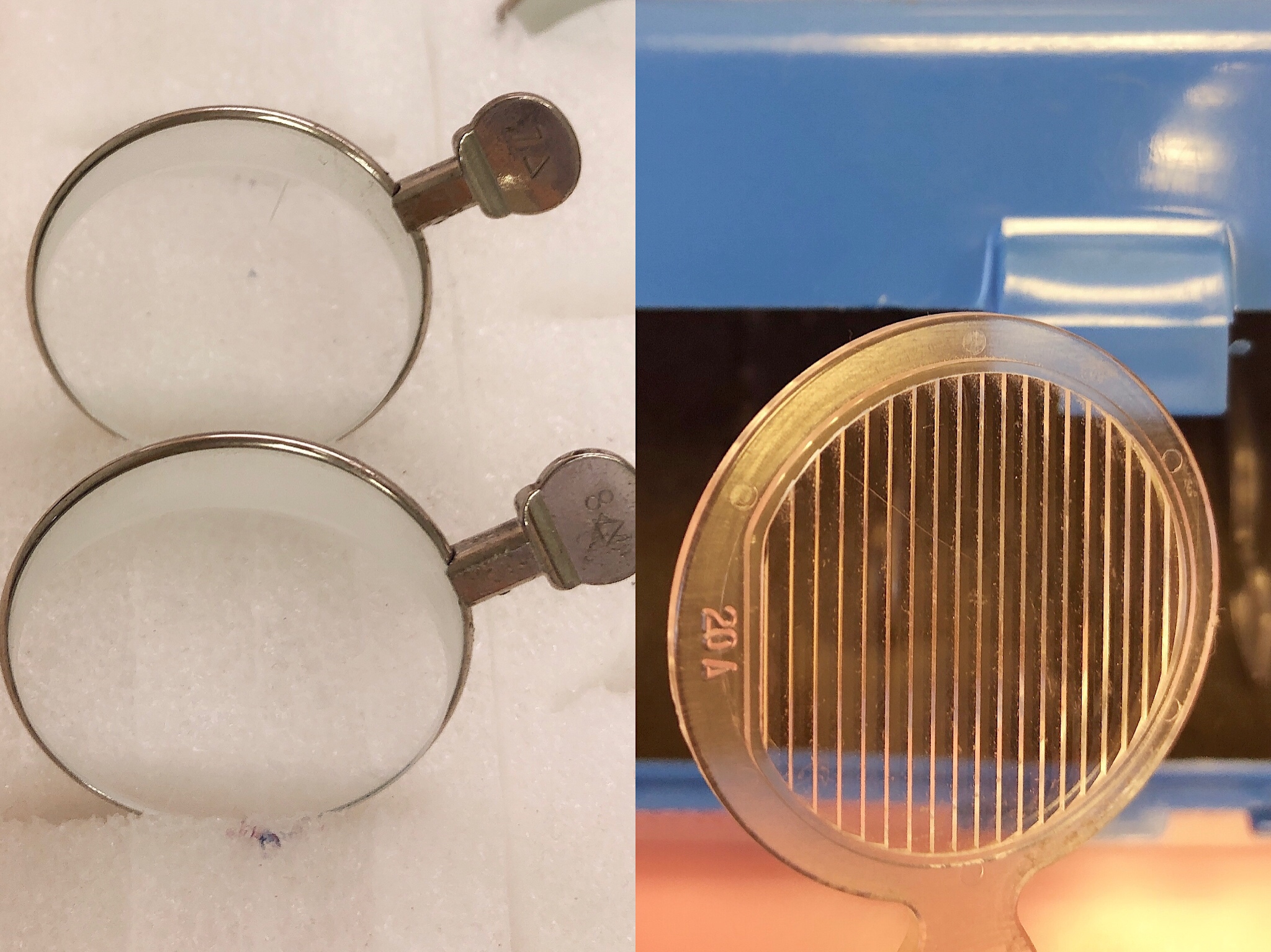 宝宝眼睛有点内斜多大治疗,儿童眼睛内斜几岁适合治疗