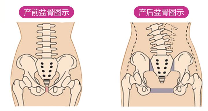 馨悦佳人盆底修复,馨悦佳人产后修复价格
