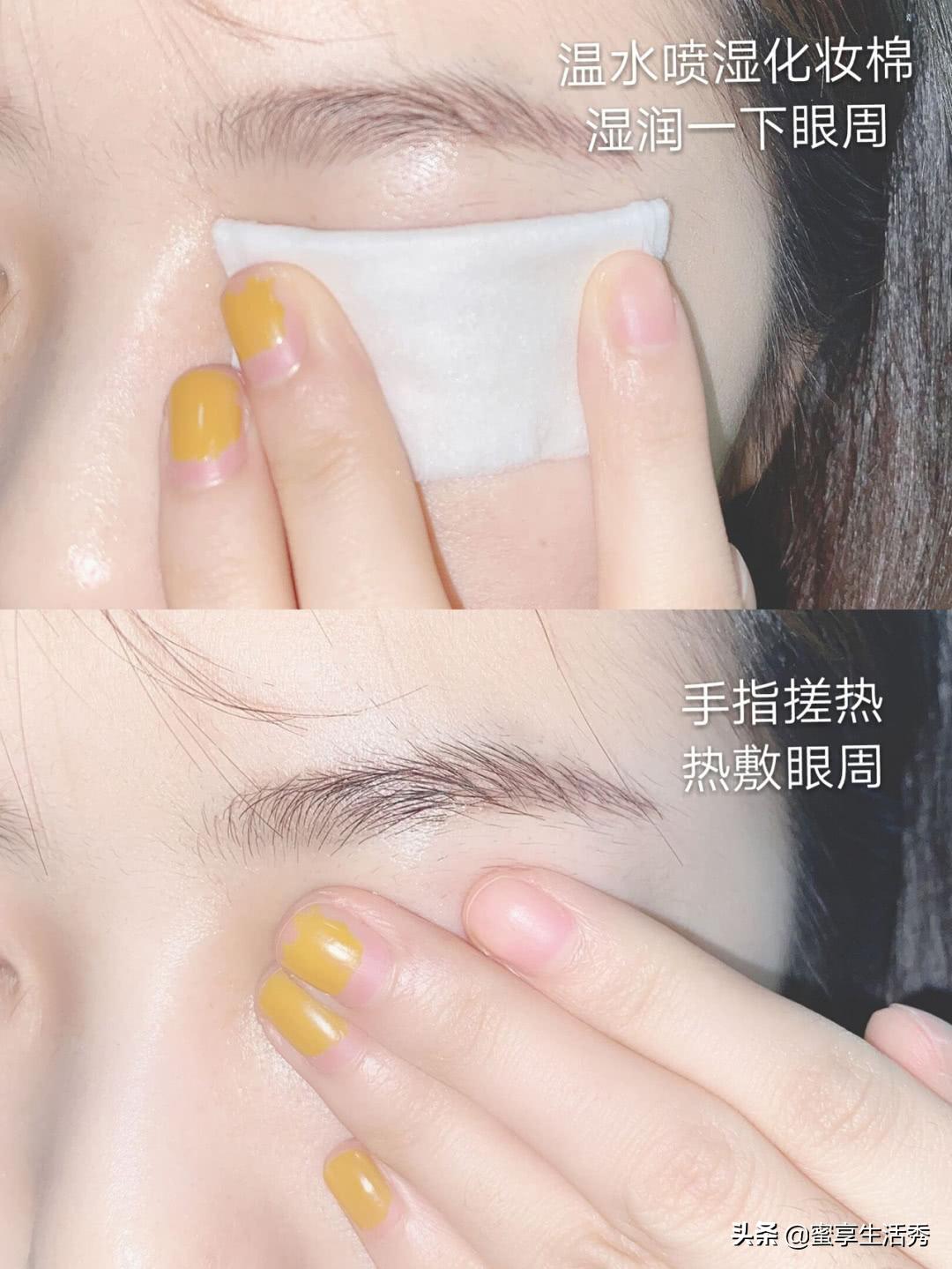 内双眼皮手术变外双效果,内双眼皮怎么变外双按摩最有效