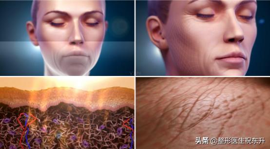 面部松弛做超声刀还是热玛吉,35岁面部松弛是选线雕还是热玛吉