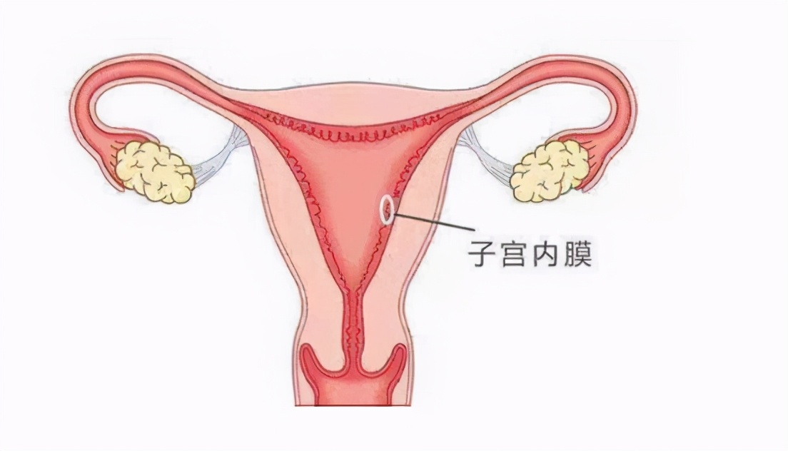 月经量少宫腔粘连可以调理吗,月经量减少宫颈粘连