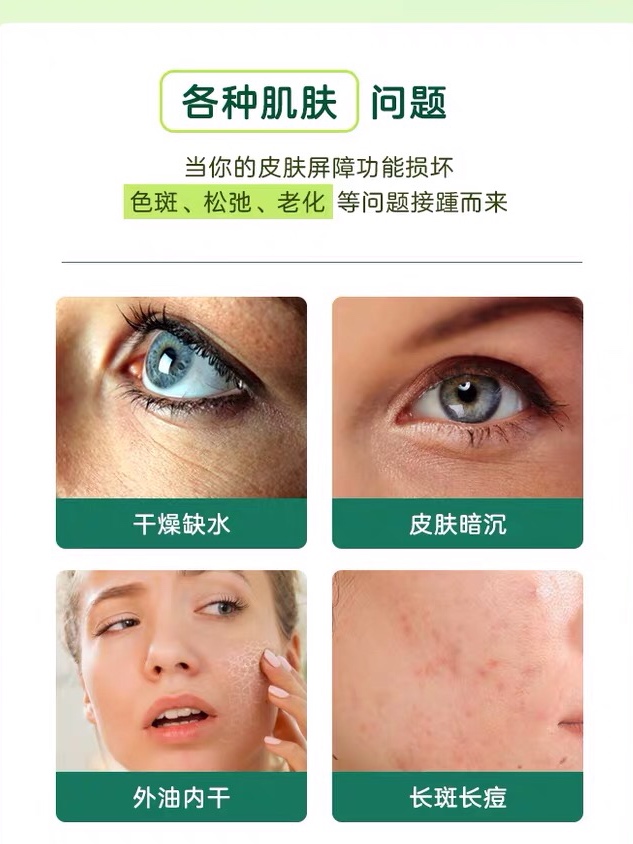 张嘉倪美貌复原,张嘉倪美颜暴击