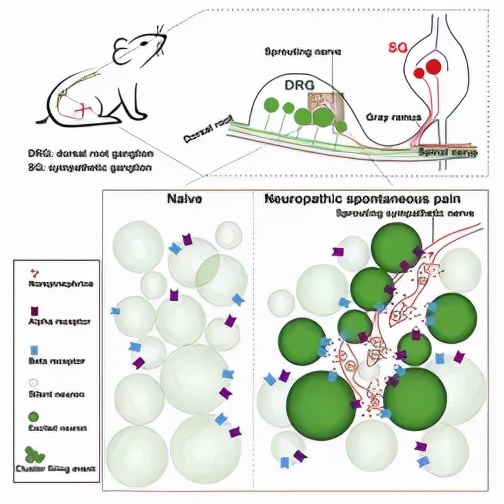 Neuron：董欣中/张俊明合作揭示神经损伤后自发性疼痛产生新机制