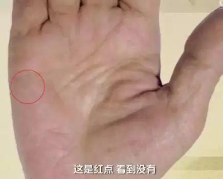 手诊10种常见病从手上就能看出来,手上健康的秘密
