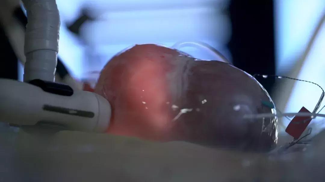 《手术两百年》国内第一部全景展现人类与疾病抗争的科学纪录片