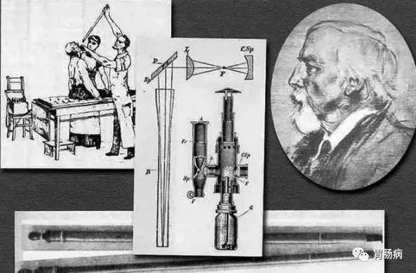 最高端的胶囊胃镜是什么技术,胶囊胃镜的基本工作原理