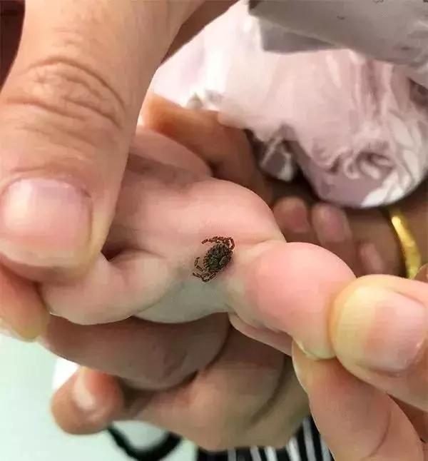 夏天最要小心这四种虫子,在外面遇到这种虫子千万别用手拍