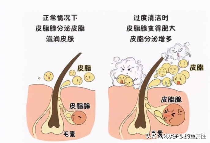 脸夏天出油冬天干燥,夏天脸出油用什么控油效果好