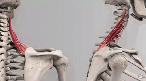 高低肩怎么健身矫正,驼背高低肩怎么矫正