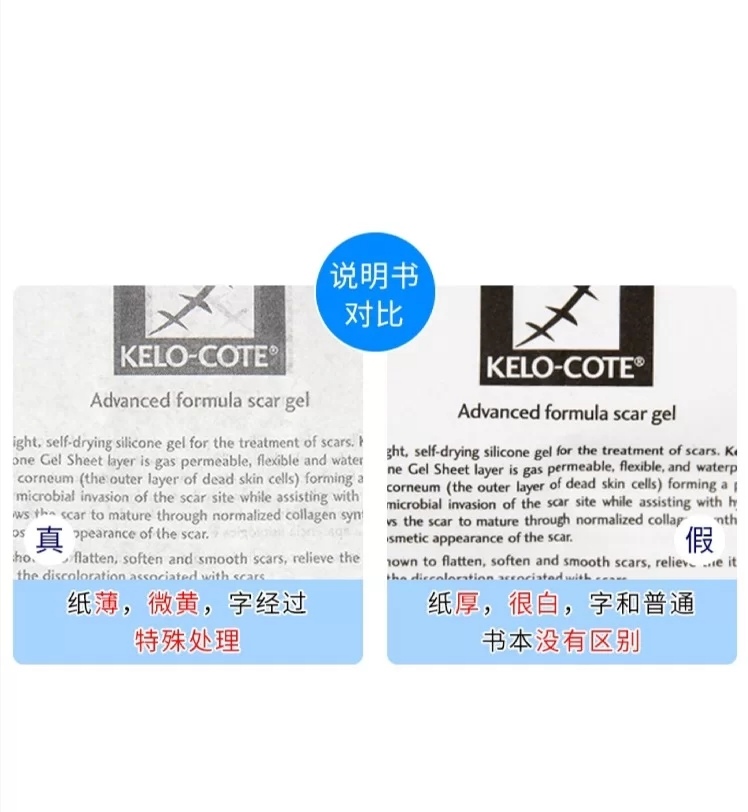 你用过最好的祛疤方法,超好用的祛疤产品