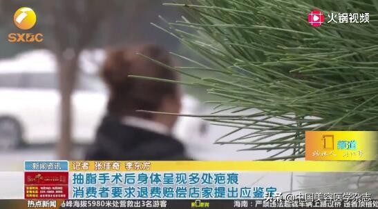 瘦脸针被召回吗,韩国知名瘦脸针被吊销许可