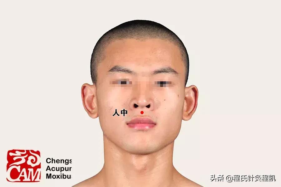 军训中暑的治疗方法,军训中暑怎么解决