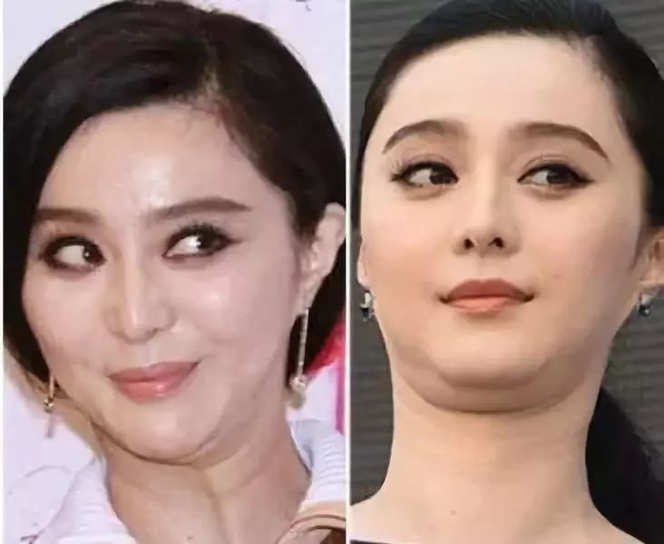 人不胖双下巴特别明显,人不胖有双下巴咋整