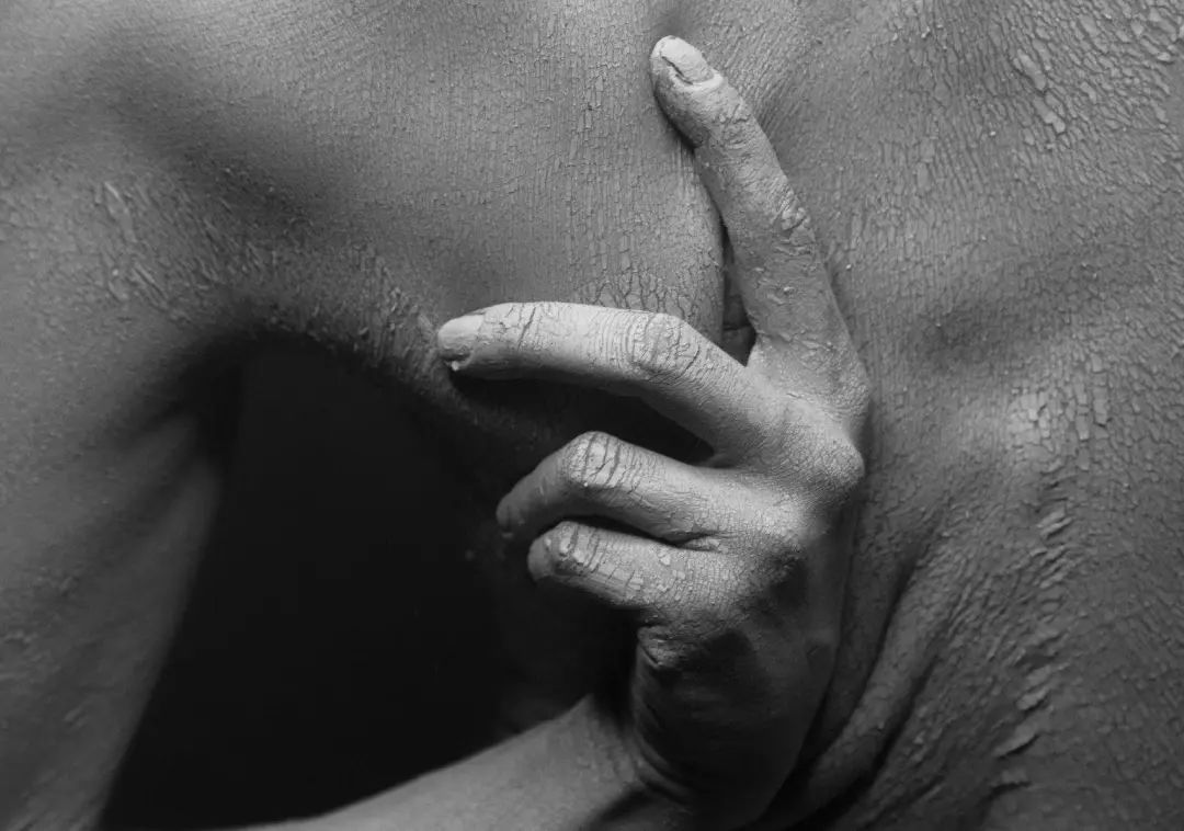 孕妇湿疹太难受怎么能缓解,湿疹最怕一招解决