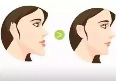 你需要去做个牙齿矫正是什么意思,为什么要做牙齿正畸