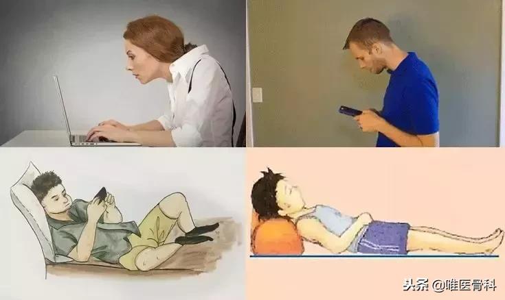 中央二台乌龟颈矫正训练,针对自己的乌龟颈怎么矫正