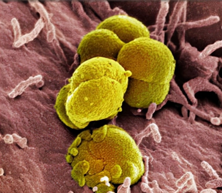 who关于hpv疫苗预防宫颈癌的建议,关注女性hpv