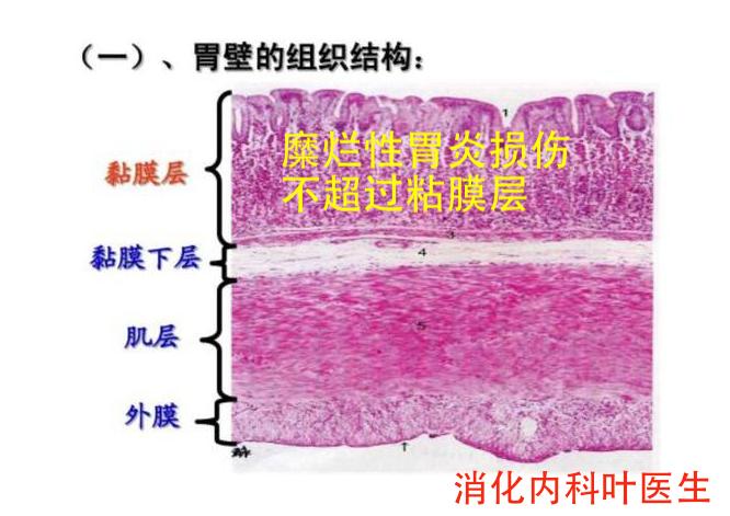 胃镜检查非萎缩胃炎伴糜烂严重吗,胃镜检查出糜烂性胃炎怎么治疗