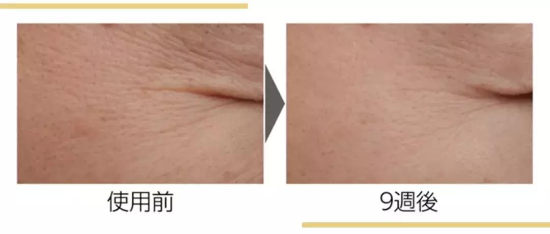 在日本销量第一品牌,资生堂口碑最好的4款