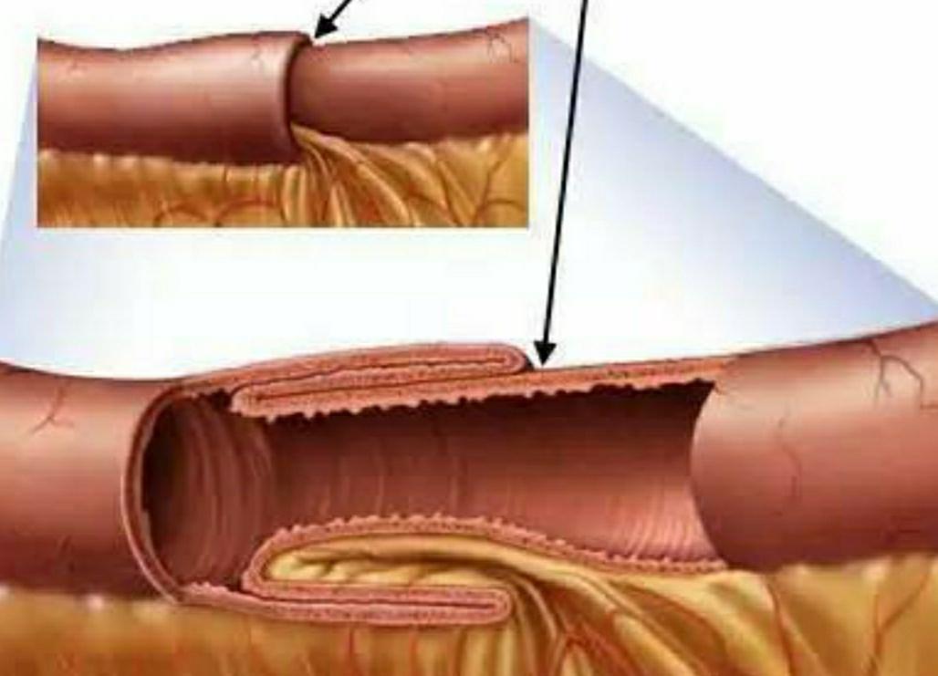 宠物细小病毒好了还吐是肠套叠,狗狗细小病毒不会流口水吧