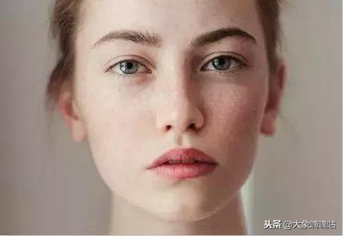 土豆片祛斑淡斑有奇效,淡斑祛斑护肤品或精油