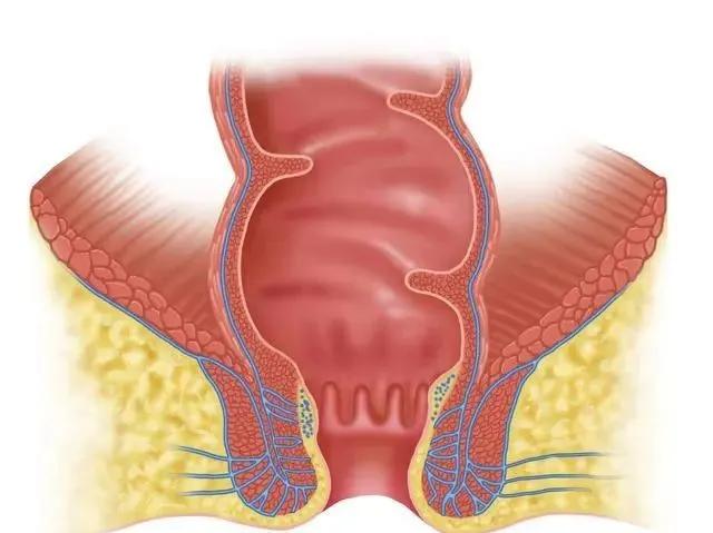 出现肛瘘了怎么办,低位肛瘘手术一个月能长好吗