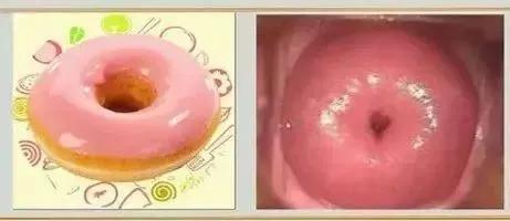 关于宫颈疾病的科普节目,宫颈筛查的注意事项科普视频