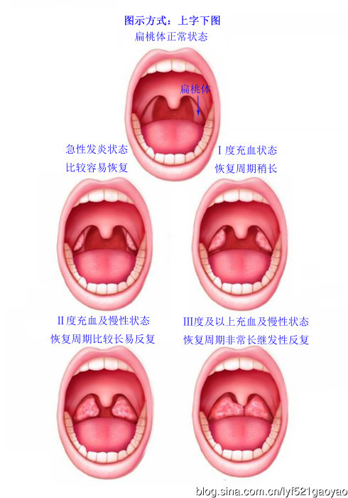 小宝高烧不退甲流,小宝持续高烧不退怎么办