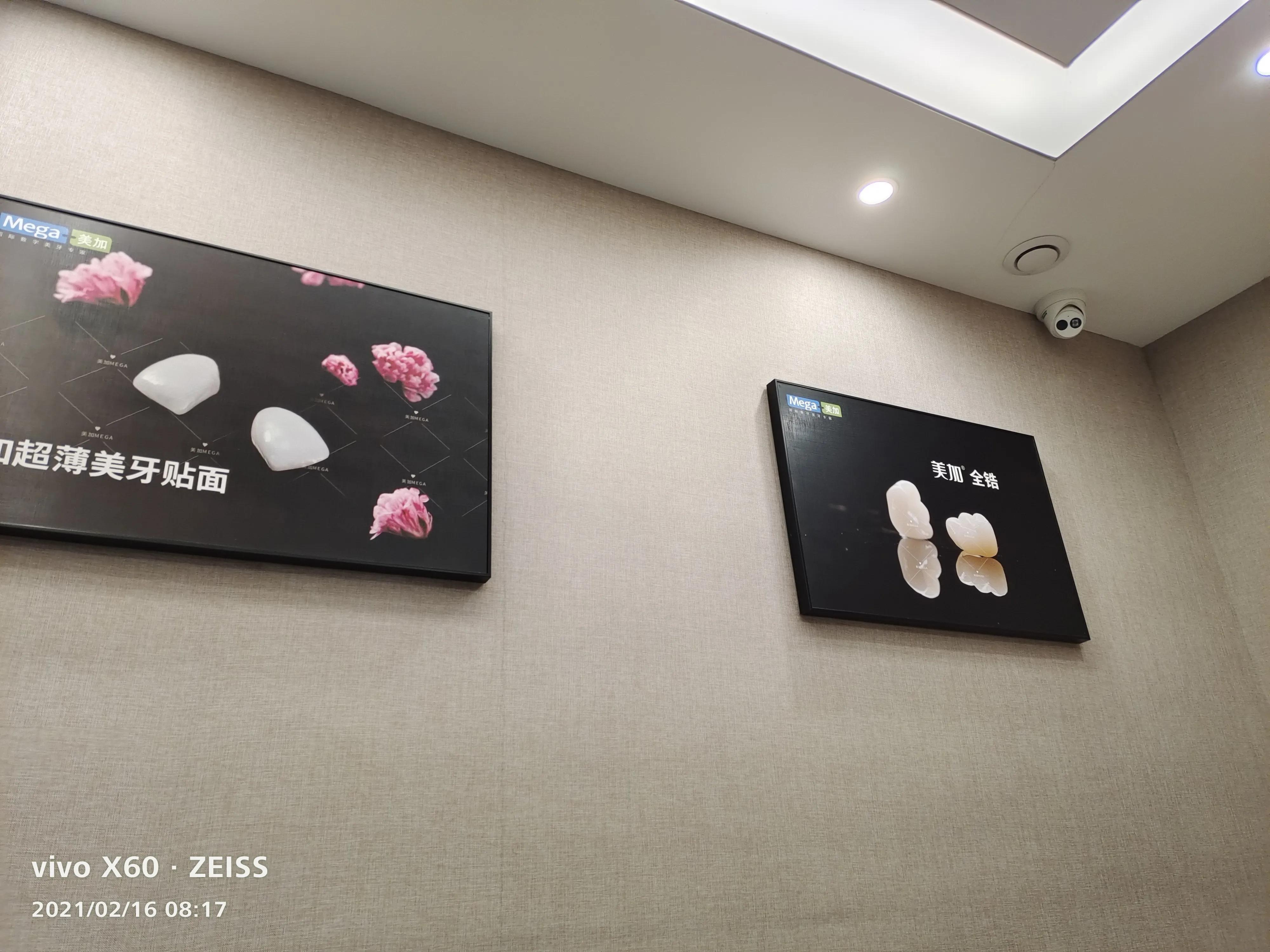 看牙24小时,看牙感觉挺好的