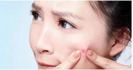 寡肽原液能祛闭合性痘痘吗,寡肽原液祛痘效果好不好